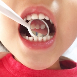 子供の口輪筋は、歯並びにも影響