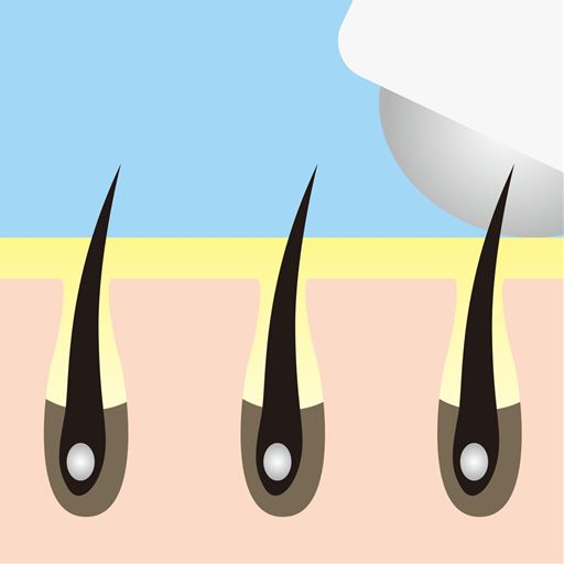 ビューナ フェイスエピグロeローラー セシール Cecile