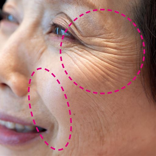 Wakac薬用シワ改善クリーム セシール Cecile