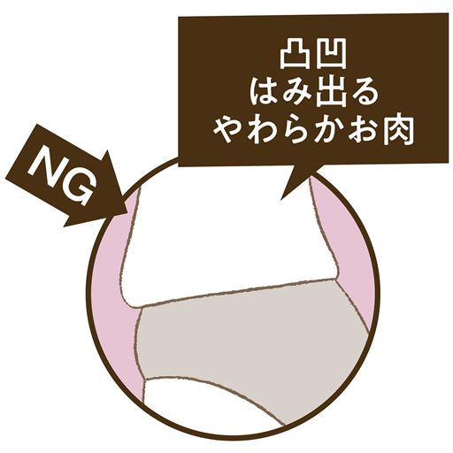 NG