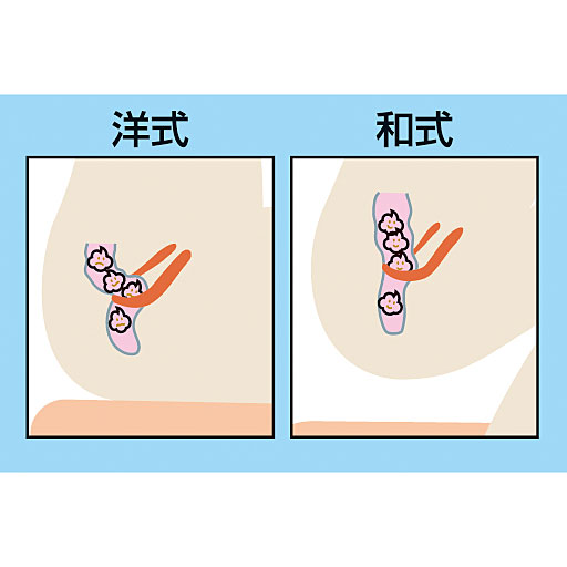 AMA Clinic 医学博士 天方義人 先生監修<br>洋式トイレの場合、腸に圧がかかりやすいと言われています。和式トイレの場合、下腹部に力が入りやすく自然に用を足すことができます。<br>※コメントは個人の見解です。<br>※イメージ