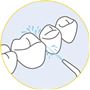 歯ブラシでは磨きづらい歯の間の汚れを強力水流でしっかり洗浄!