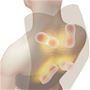 肩 上下8つのもみ玉の立体的な動きで心地よく肩や肩甲骨周りをほぐします。<br>※イメージ