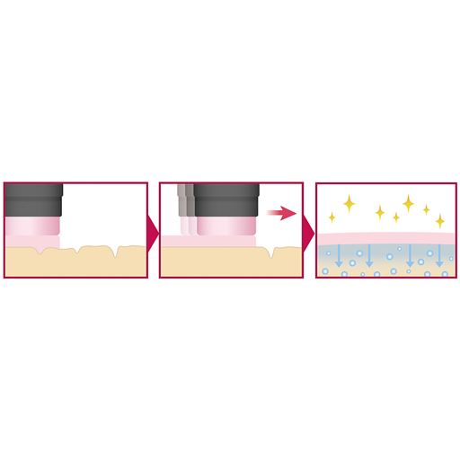 ［お肌に密着して潤いパック効果］<br>左:体温によってバームが溶け出す<br>真ん中:引き上げるように塗って肌の凹凸を埋める。<br>右:肌表面に膜を張り美容液を閉じこめてパック。※イメージ