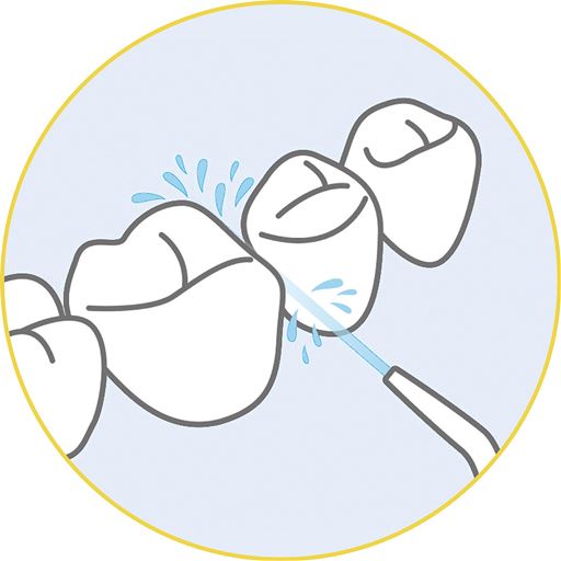 歯ブラシでは磨きづらい歯の間の汚れを強力水流でしっかり洗浄!
