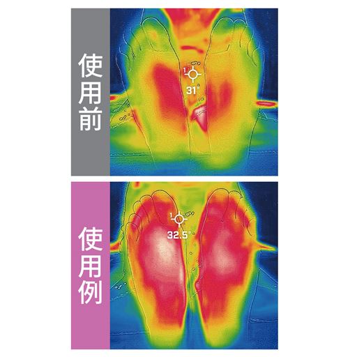履くことで血行をよくする! 着用前、及び着用後着座静止20 後の足裏表面をサーモグラフィカメラ(FLIR)にて撮影