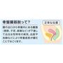 骨盤臓器脱って?