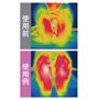 履くことで血行をよくする! 着用前、及び着用後着座静止20 後の足裏表面をサーモグラフィカメラ(FLIR)にて撮影