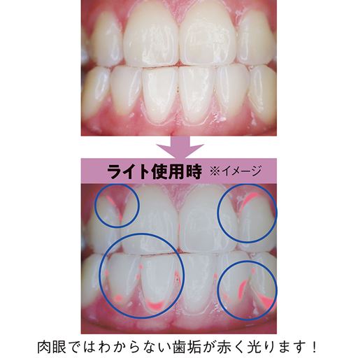 肉眼ではわからない歯垢が赤く光ります!