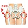 気になる大転子の張り出しをサポート!
