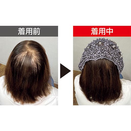 つむじにも! <br>※着用効果には個人差があります。