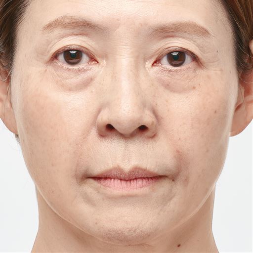 使用前
