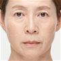 使用例<br>※皮膚形成による物理的効果(塗布時の一時的効果)<br>※仕上がりには個人差があります。