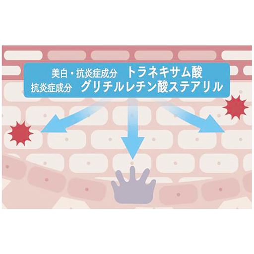 ダメージを受けた肌に。有効成分をしっかり届けてシミ・そばかす(※A)、肌あれを防ぐ。<br>※肌断面イメージ図。※A メラニンの生成を抑え、シミ・そばかすを防ぐこと。