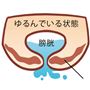 こんなお悩み、ありませんか!?<br> (1)ウォーキングやジムなどでの運動時に(2)せきやくしゃみの腹圧で「あっ!」(3)重い荷物を持ち上げた拍子に「ドキッ」