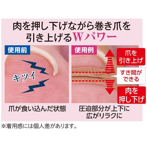肉を押し下げながら巻き爪を引き上げるWパワー ※イメージ