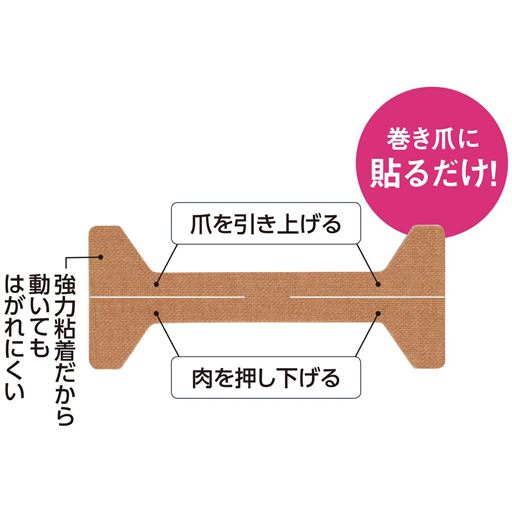 肉を押し下げるだけでなく、巻き爪を上に引き上げるダブルのパワーで巻き爪のツラさをラクに。