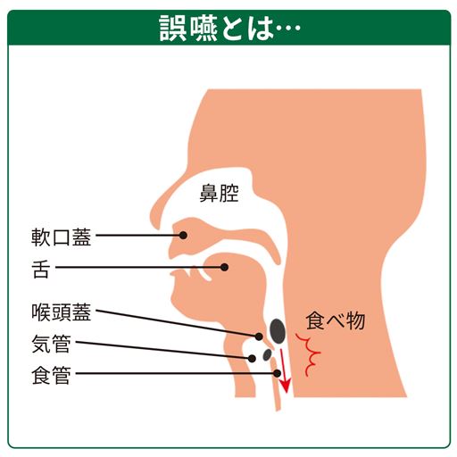 食べ物や飲み物の一部が誤って気管に入ってしまうこと。年齢による嚥下機能低下も原因のひとつとされています。