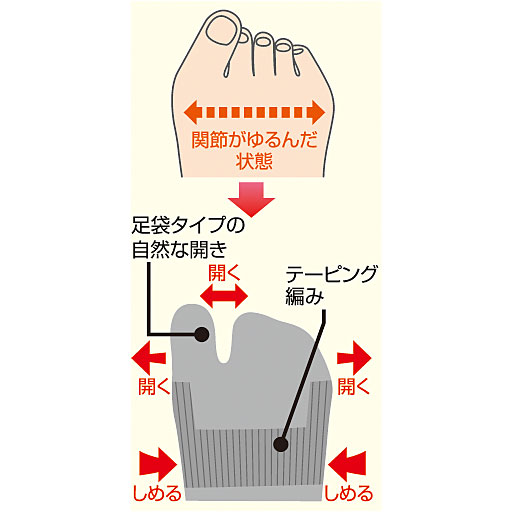 ゆるんだ関節をテ-ピング編みでしめつけることで自然に指を開きます。<br>※イメージ<br>※指の開き具合には個人差があります。