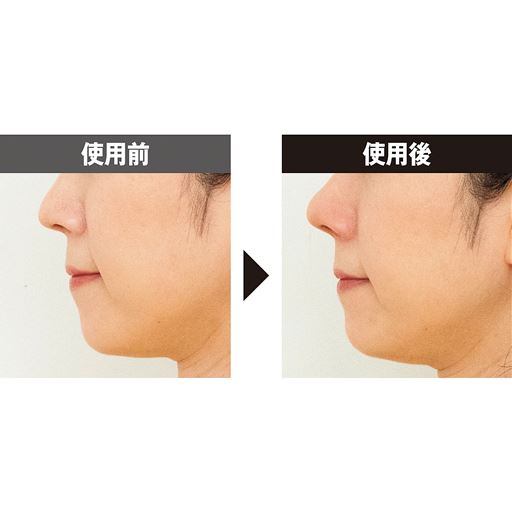 ※メーカー調べ。結果には個人差があり、効果を保証するものではありません。※本品を10分使用した一時的な結果です。※モニター8名中1名のデータ。