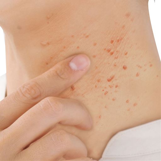 目元や首元などのポツポツを集中ケア。<br>※イメージ