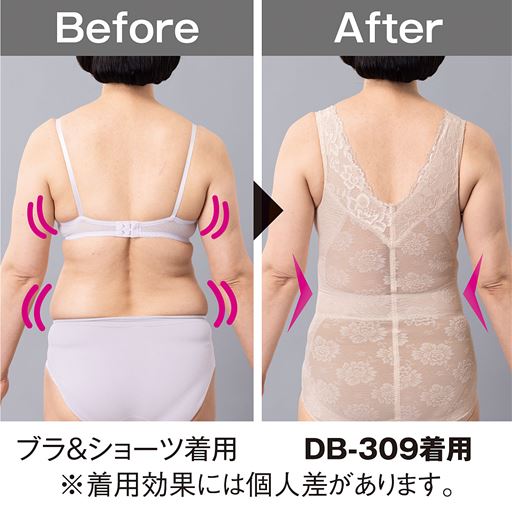 お肉の段差をフラットにしてすっきりシルエットに