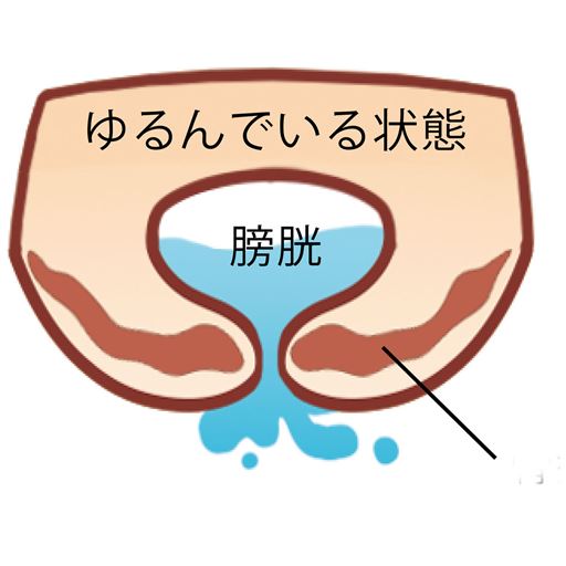 ※イメージ図 (1)骨盤底筋 ゆるんでいる状態 膀胱