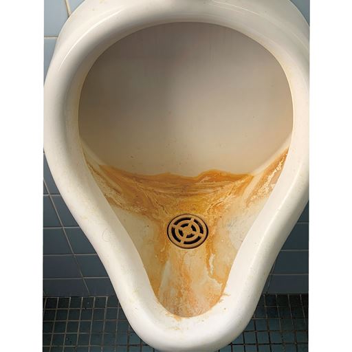 Before<br>10年間何をしても落ちなかったのに…