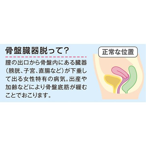 骨盤臓器脱って?