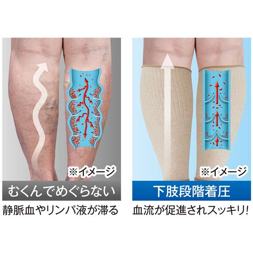 段階着圧 昼間に血行促進!余分にためない!