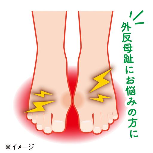 外反母趾にお悩みの方に。※イメージ
