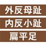 外反母趾 内反小趾 扁平足に