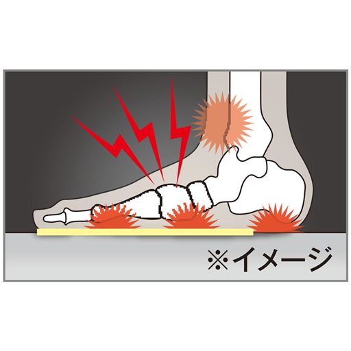 健康の源は「足底アーチ」のケアから 衝撃をうけやすい扁平足