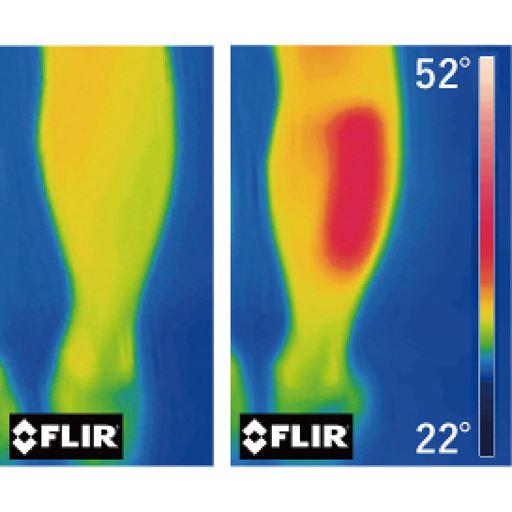 左:使用前 右:使用後 ひんやりとした足に温熱ヒーター!※商品を10分使用、メーカー調べ。
