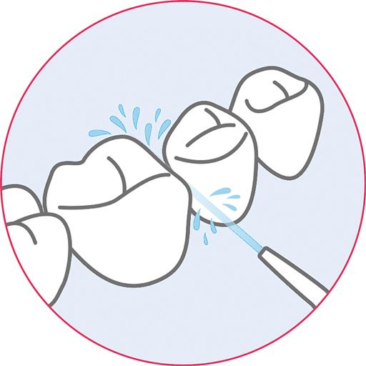 磨きづらい歯の間の汚れを強力水流でしっかり洗浄!