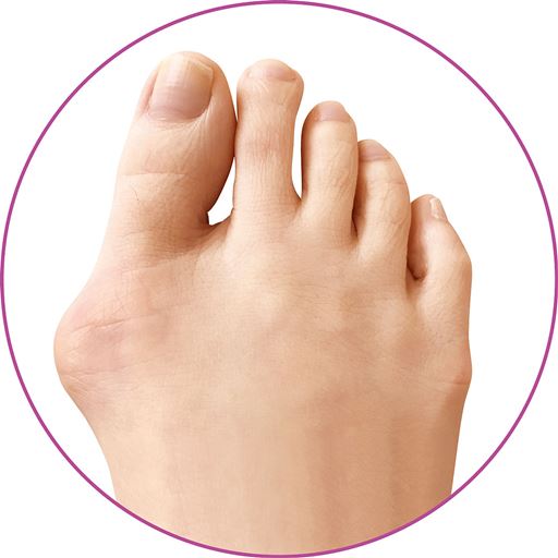 歩くとココが痛い