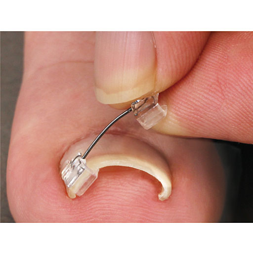 フックを爪に引っ掛ける