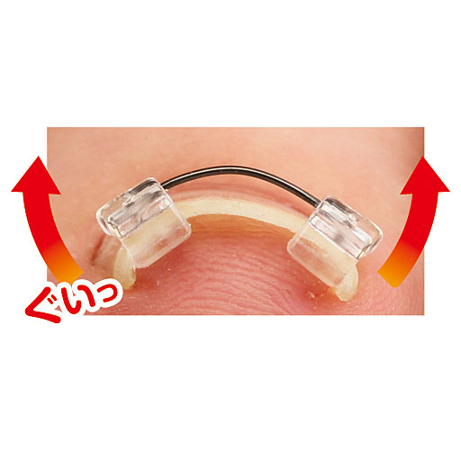 ワイヤーが爪を引き上げる