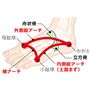 親指に舟状骨が、小指に立方骨が対応。舟状骨と立方骨を持ち上げアーチをしっかり作ることで親指と小指が自然に開き、正しい位置にキープ。 ※使用感には個人差があります。