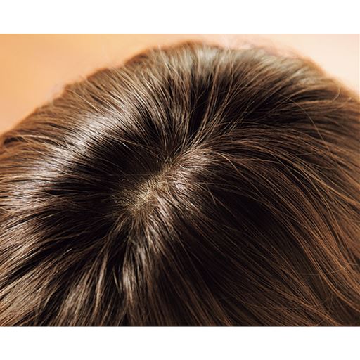 人工地肌付きで自然なつむじ