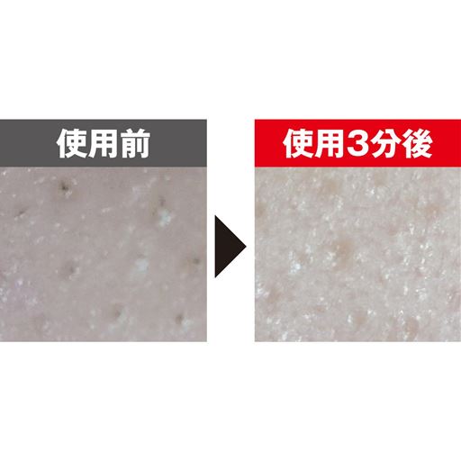 皮脂汚れや古い角質オフ(SONICモード3分間使用) <br>※メーカー調べ。結果には個人差があり、効果を保証するものではありません<br>※本品を使用した一時的な効果です