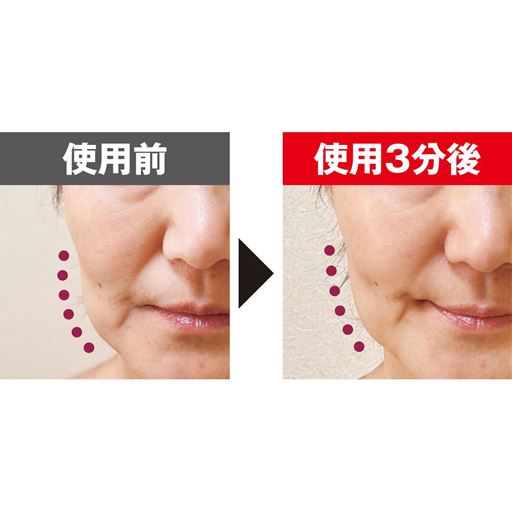独立EMSで表情筋を刺激(EMSモード5分間使用)<br>※メーカー調べ。結果には個人差があり、効果を保証するものではありません<br>※本品を使用した一時的な効果です