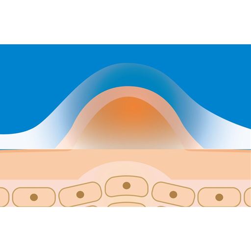 気になるポツポツ(※A)をクリームがしっかり包みます。<br>※イメージ<br>※A 古い角質の固まり