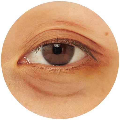 気になるだるだる目袋や黒ずみ目袋に<br>※イメージ