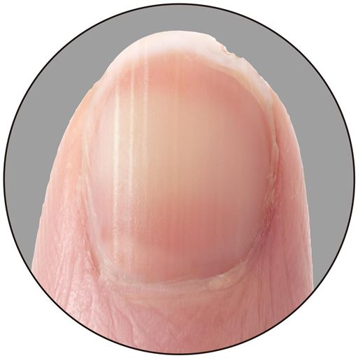 傷んだ爪のイメージ