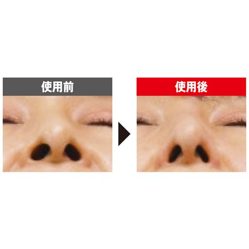 EMS(※1)で引き締まった美鼻を目指す<br>※メーカー調べ。 結果には個人差があり、効果を保証するものではありません。※モニター4名中1名のデータ。