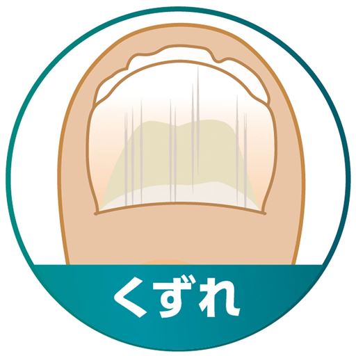 ～その悩み菌が原因かも～<br>くずれ<br>※イメージ