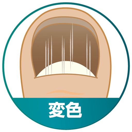 ～その悩み菌が原因かも～<br>変色<br>※イメージ