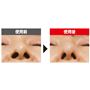 EMS(※1)で引き締まった美鼻を目指す<br>※メーカー調べ。 結果には個人差があり、効果を保証するものではありません。※モニター4名中1名のデータ。