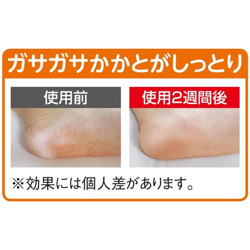 ガサガサかかとがしっとり